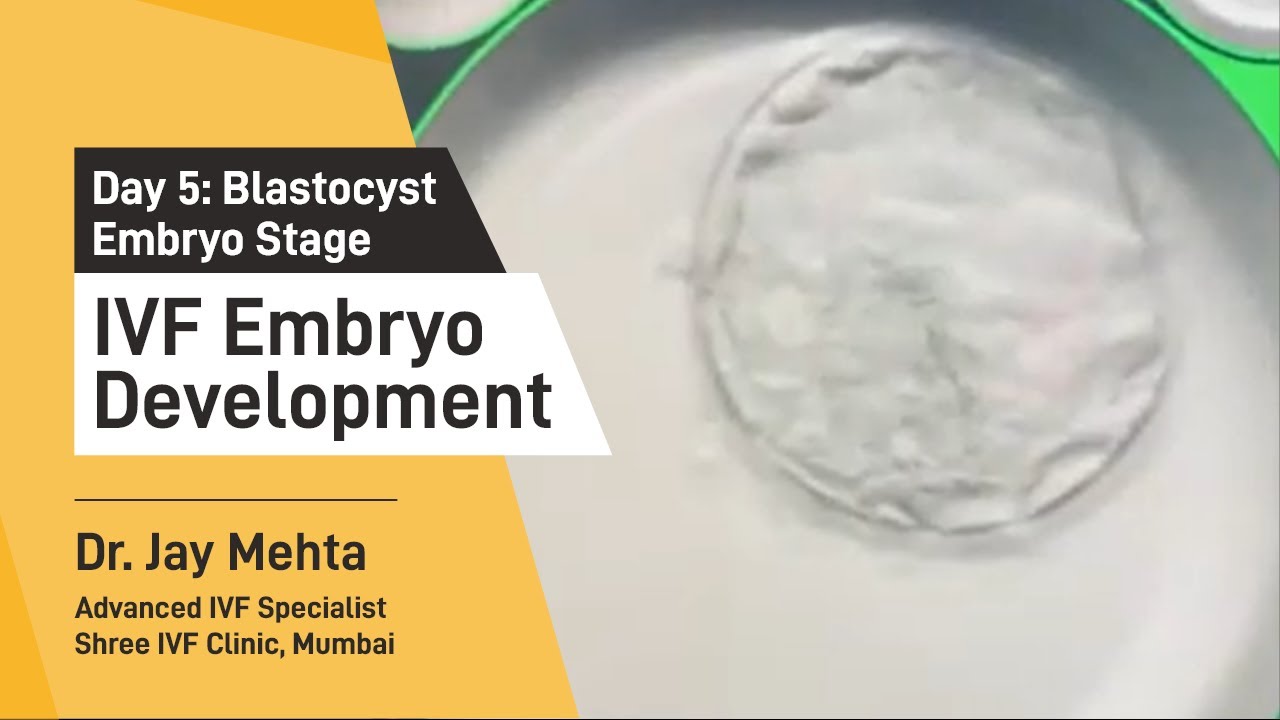 Blastocyst Embryo Stage | IVF Embryo Development-Day 5  | Time-Lapse Imaging Part 4| Dr Jay Mehta