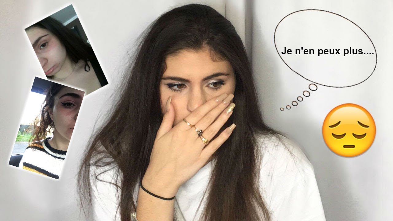 MA DESCENTE AUX ENFERS ( eczéma, peau atopique, allergies )