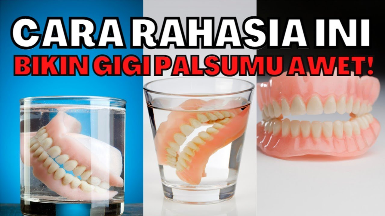 Cara merawat gigi palsu permanen dan gigi palsu lepasan agar awet dan tidak bau !