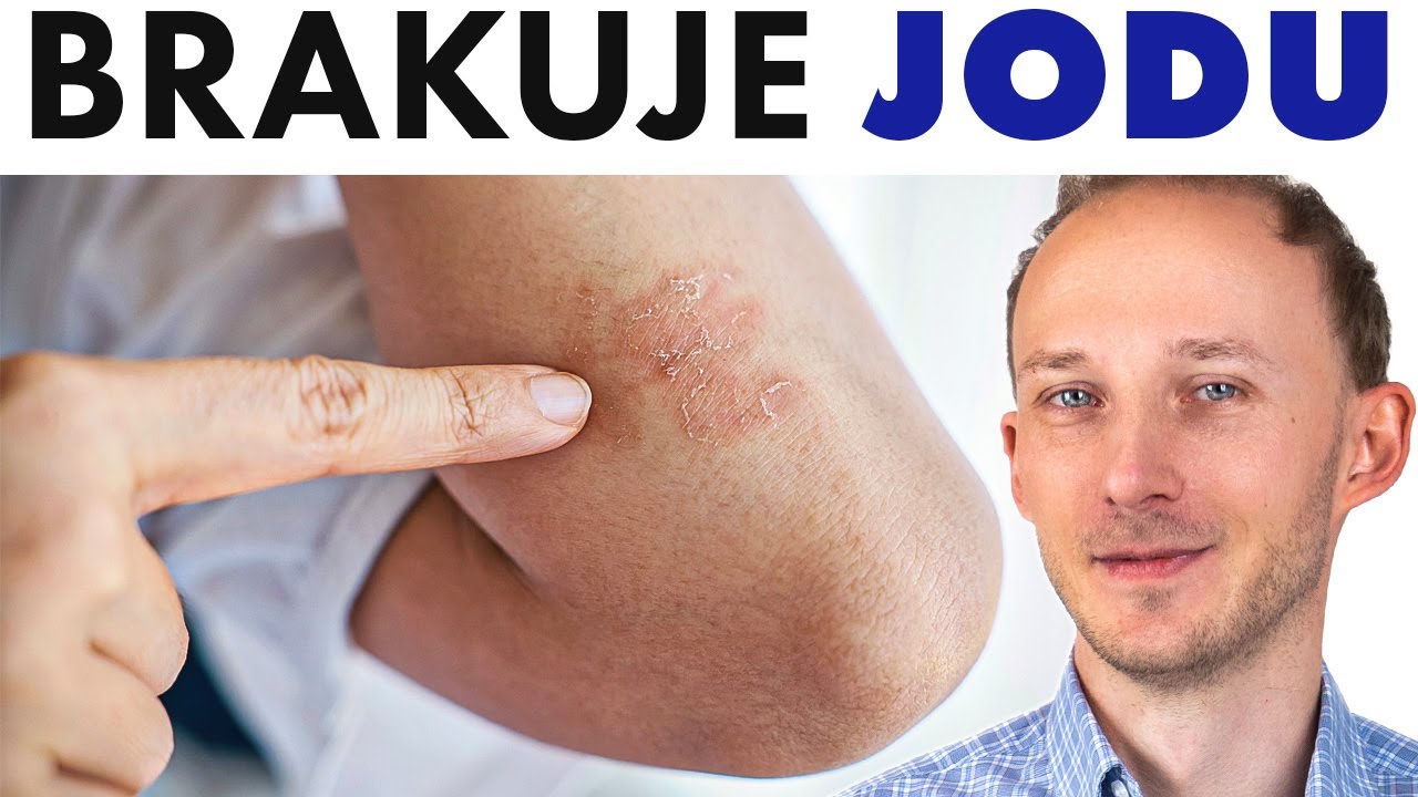 Tak ciało ostrzega, że brakuje Ci JODU + jak cofnąć niedobór