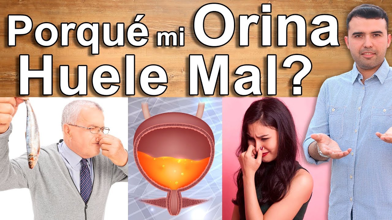 &iquest;Porque Mi Orina Huele Mal? - El Olor De Tu Orina Dice Mucho de Tu Salud - Mal de Orin, Infecci&oacute;n