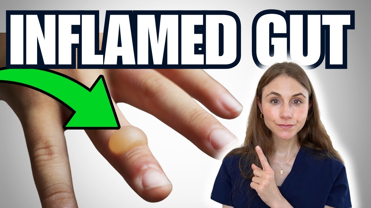 Signs Of Gut Inflammation NOT TO MISS | Skin Problems