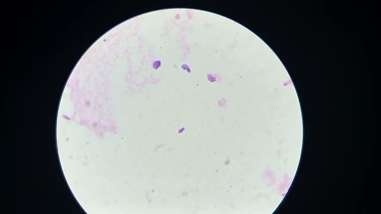 Spermocytogramme #spermogramme  تعرف على عاهات الحيوانات المنوية