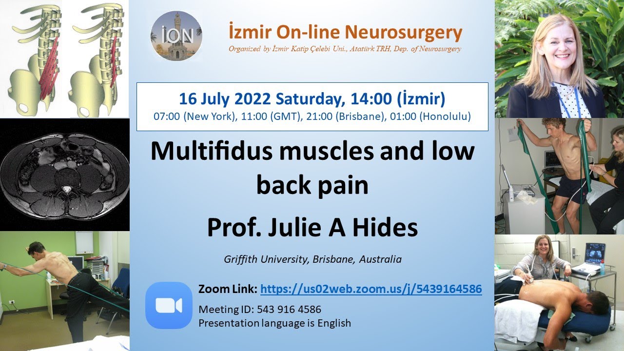 ION 259. ZOOM lecture, Hides: Multifidus muscles and low back pain 16.07.22
