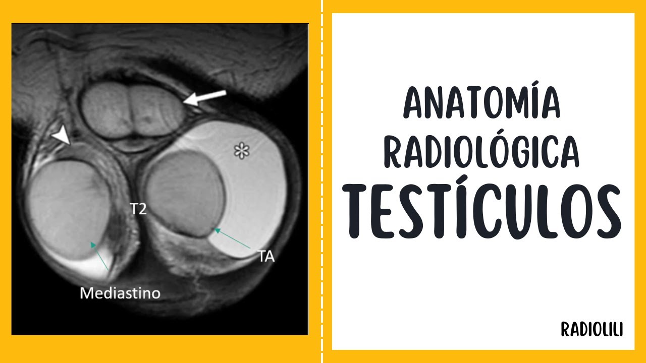 Anatomía radiológica de los testículos: Radiología en 5 minutos.