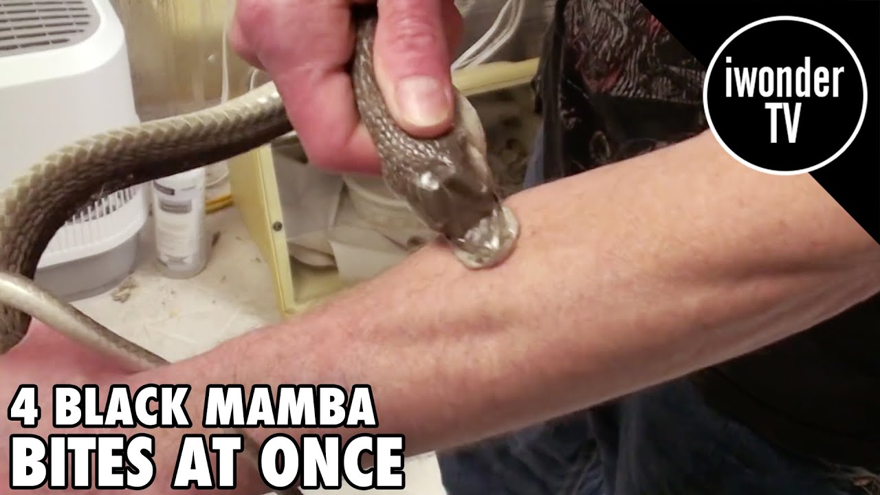 Surviving A Black Mamba Snake Bite - Venom Man