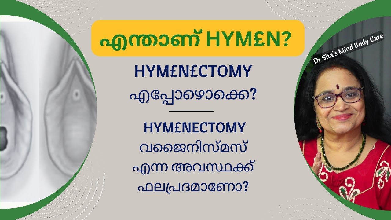 What is HYM£N? | When is HYM£N£CTOMY done? | Is HYM£NECTOMY effective for Vaginismus? | Malayalam