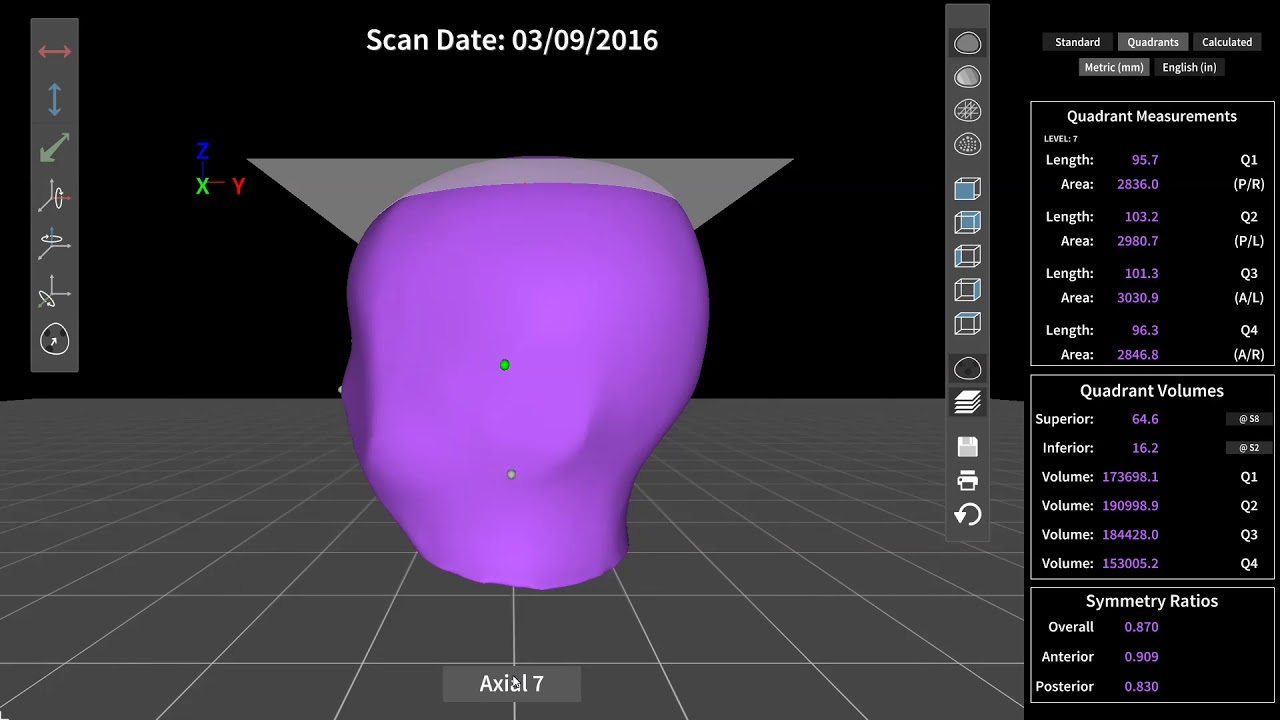 Measurement & Comparison Utility - Orthomerica 3D Scanning
