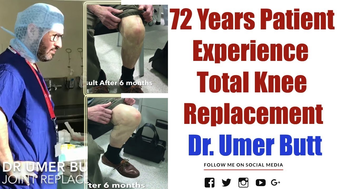 72 Years Patient Recovery Experience - Total Knee Replacement By Dr. Umer Butt Orthopedic Surgeon