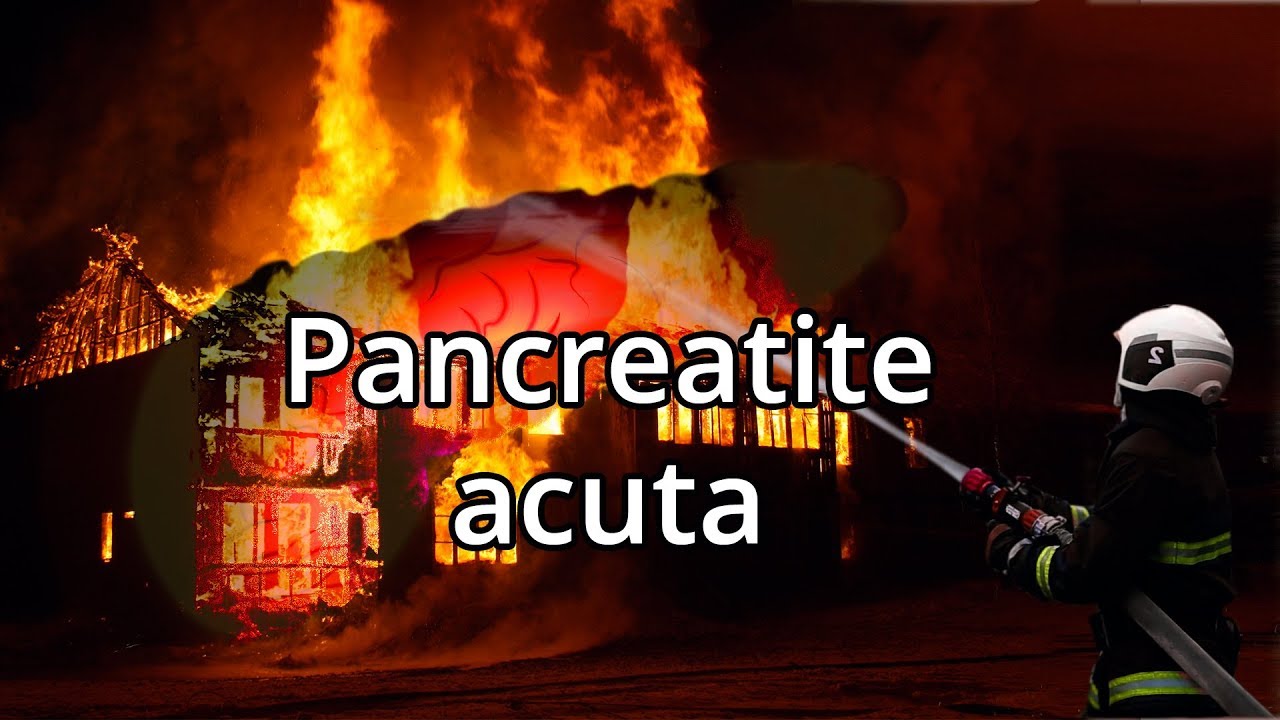 PANCREATITE ACUTA: Una condizione improvvisa adesso - Spiegazione