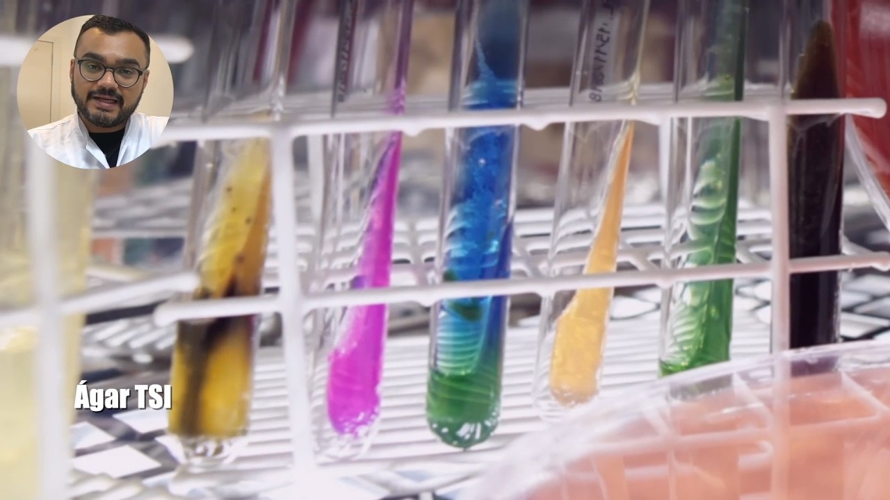 Como interpretar o ágar TSI para identificação de bactérias? | Microlab Educacional