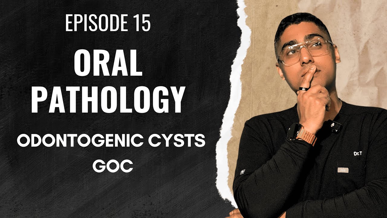 Dental Digest | Oral Pathology | Episode 15 – Glandular Odontogenic Cyst (GOC)