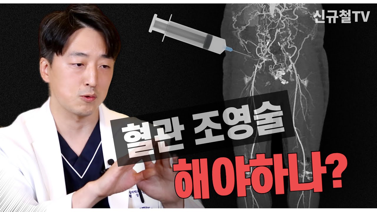 혈관 조영술이란? 무엇이고... 언제 어떨때 해야할까요? 조영술의 장점과 단점 그리고 부작용은?