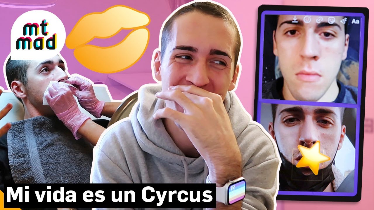 Jorge Cyrus se retoca los labios por primera vez y ense&ntilde;a el espectacular resultado | mtmad