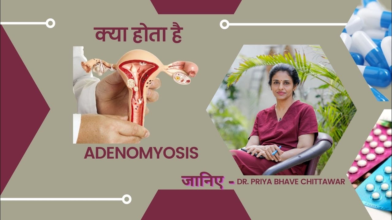 क्या होता है   Adenomyosis जानिए  Dr. Priya Bhave Chittawar