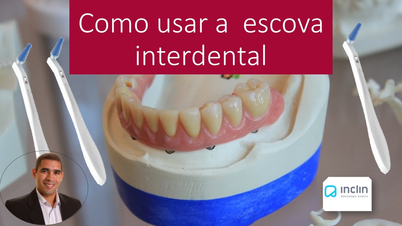 Como usar a escova interdental.@dr.alexguedes
