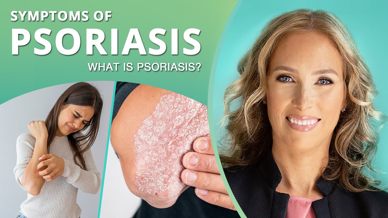 Symptoms of Psoriasis | Dr. J9 Live