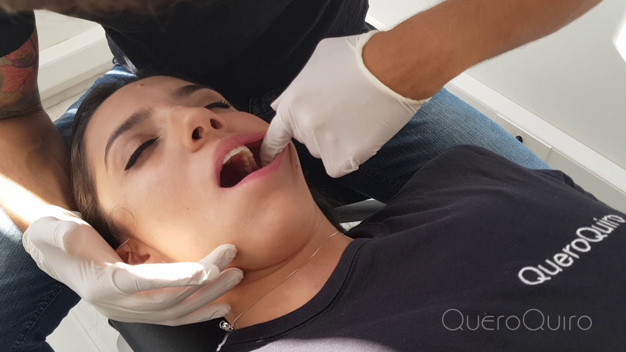 Tratamento de Bruxismo - QueroQuiro