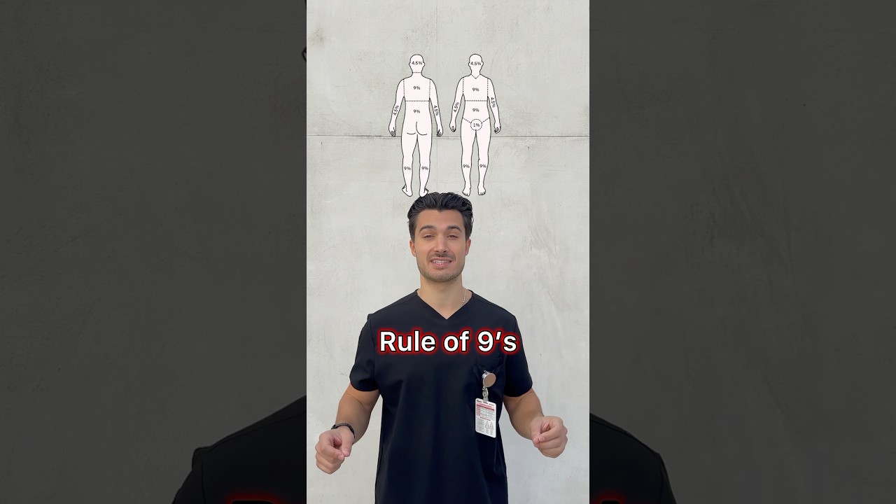 Easy trick for Burns Management 🔥#medstuden #medschool #usmle #usmlestep1 #surgery #surgeon