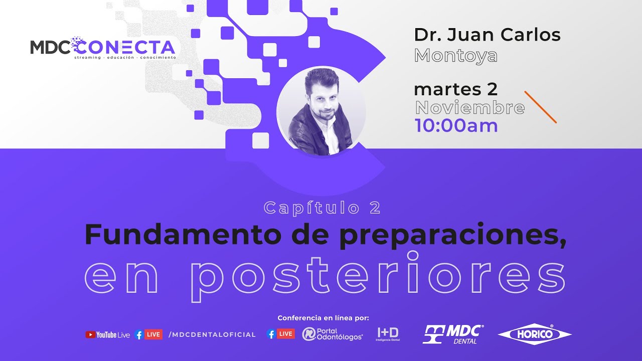 Conferencia en Línea: Capitulo 2 Fundamento de preparaciones en posteriores