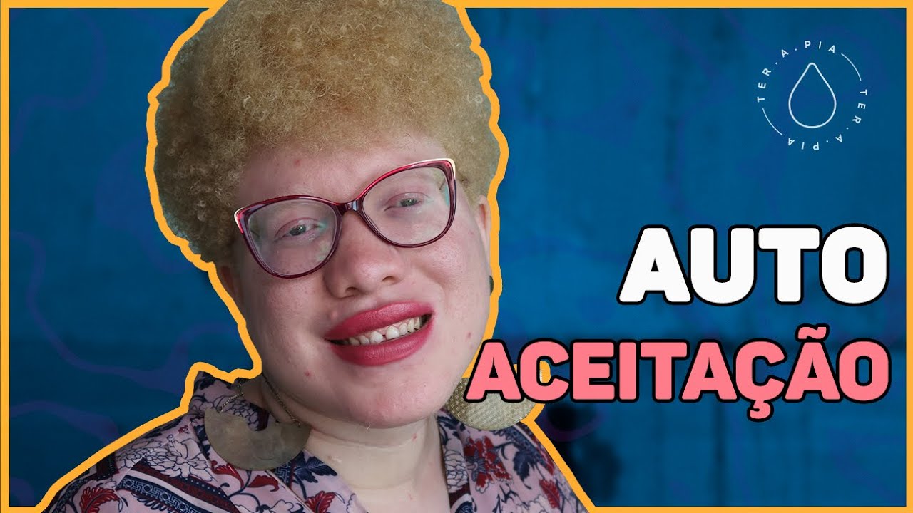 EU SOU ALBINA E SOU MARAVILHOSA | Histórias de ter.a.pia #109
