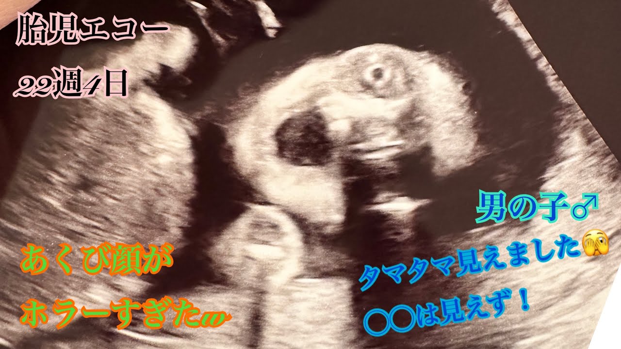 【妊娠6ヶ月(22週4日)】胎児エコーでタマタマ見えました【第二子】