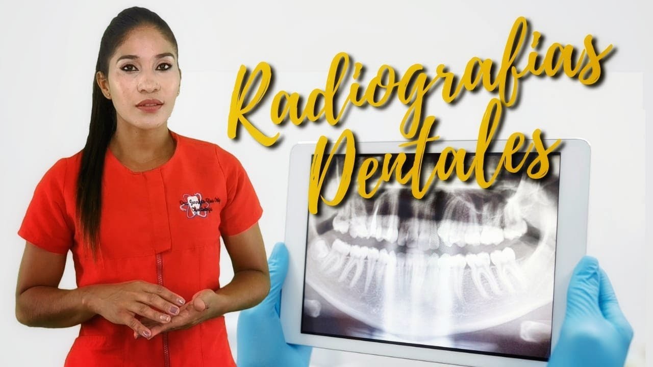 😁👄🦷Por Qué  Es Tan Importante La Radiografias Dentales En La Valoración Inicial🦷👄✨😉