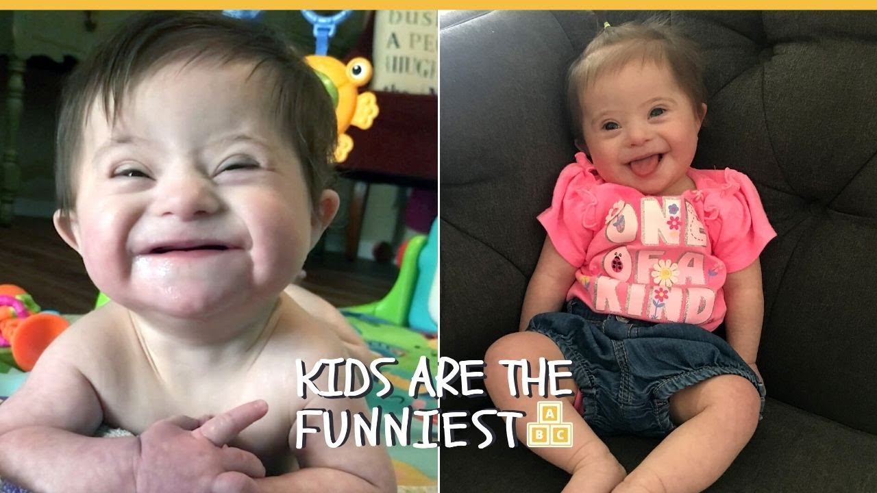 Baby With Down Syndrome Shows Off 'New Smile' After Adoption