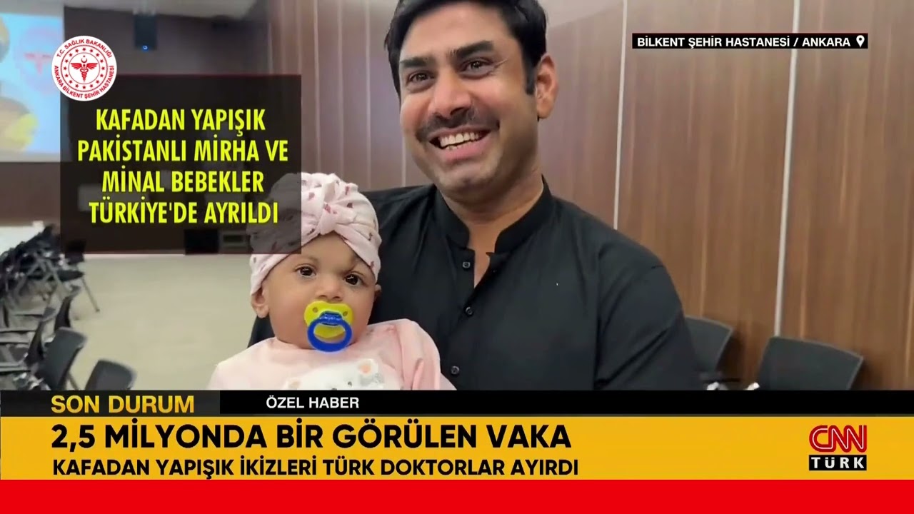 Bilkent Şehir Hastanesi'nin Büyük Başarısı: Yapışık İkizler Başarılı Ameliyatla Ayrıldı