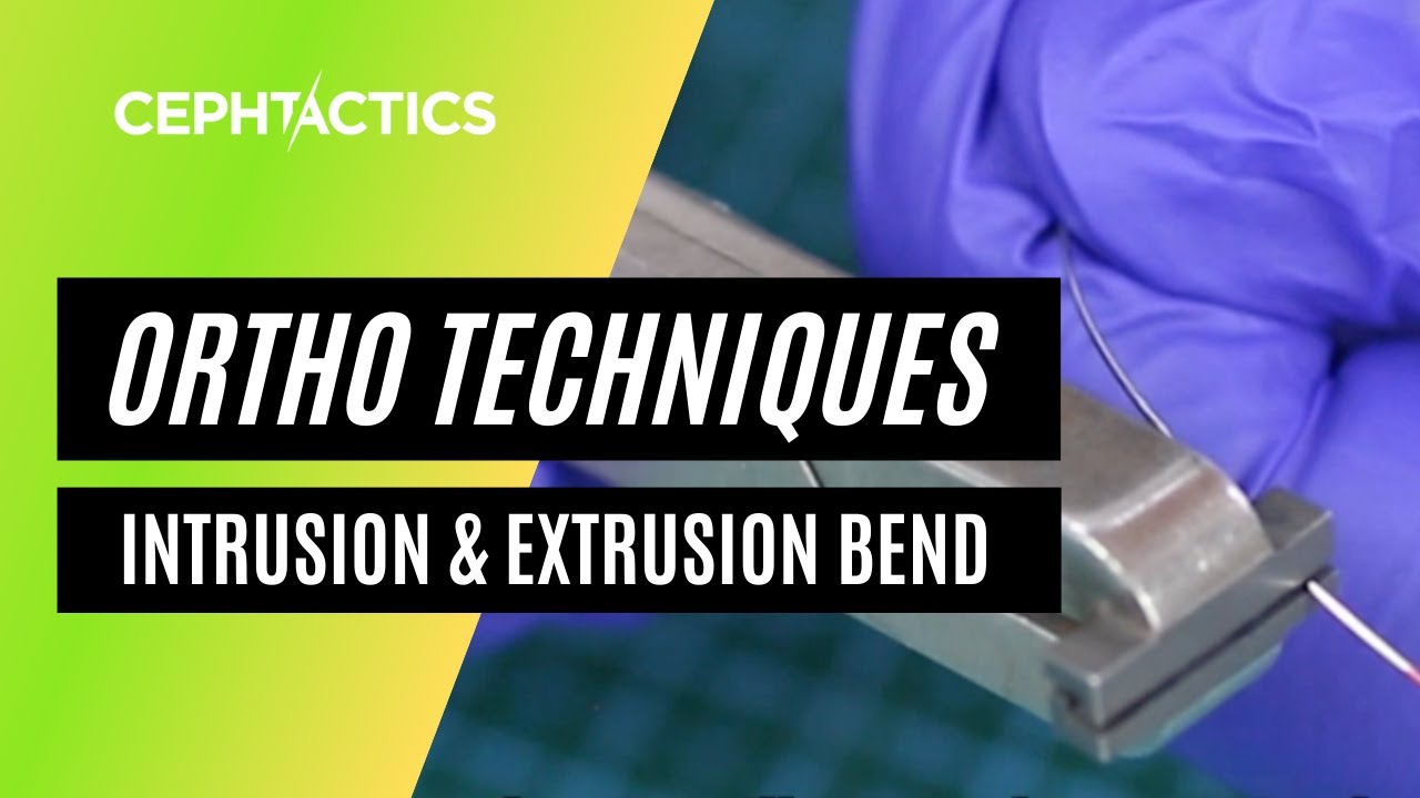 Intrusion and Extrusion Bends in Orthodontics
