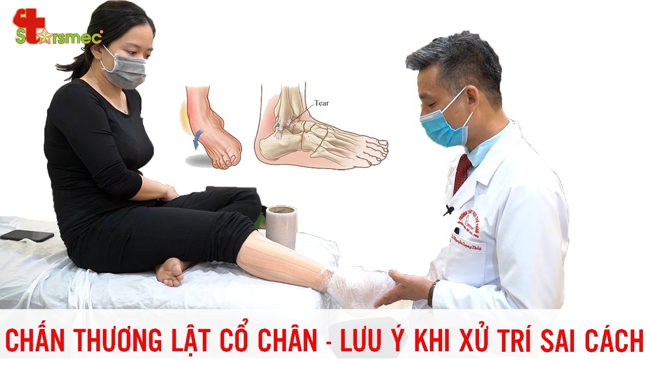 Trị Bong Gân Chân ngay Tại Nhà đúng cách? - Bác sĩ Nguyễn Trọng Thủy