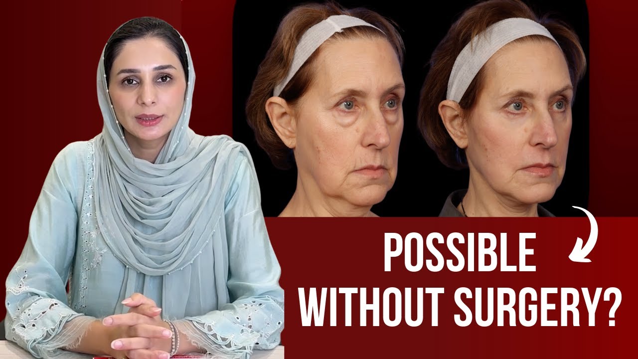 Do You Really Need a Facelift? Botox, Fillers & Non-Surgical Options