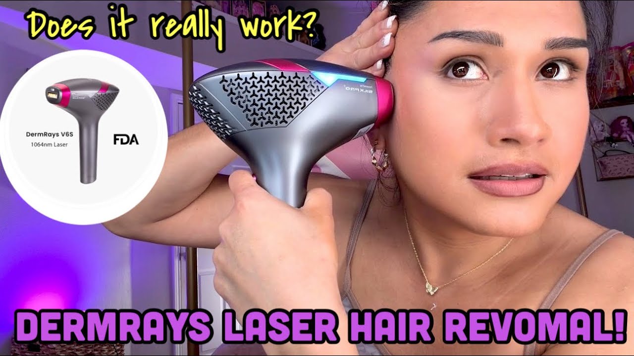 DermRays Laser Hair Removal At Home! Does this really work? 