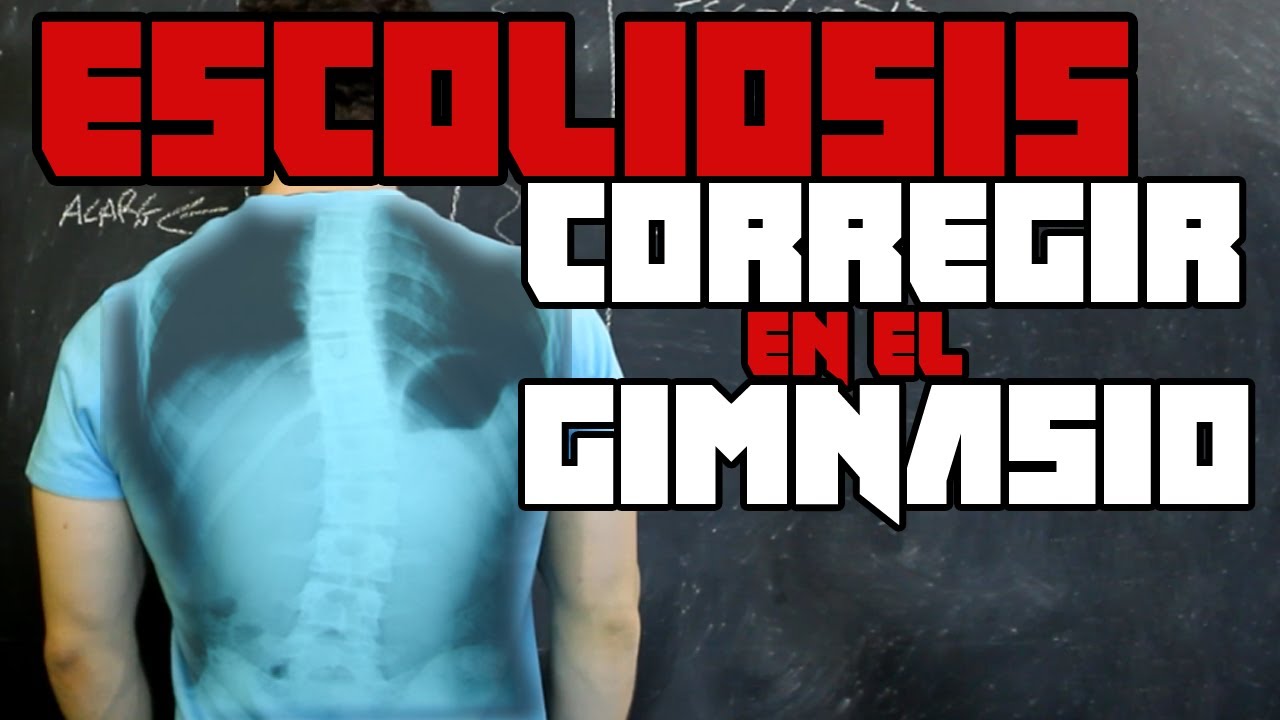 CORREGIR ESCOLIOSIS EN EL GIMNASIO