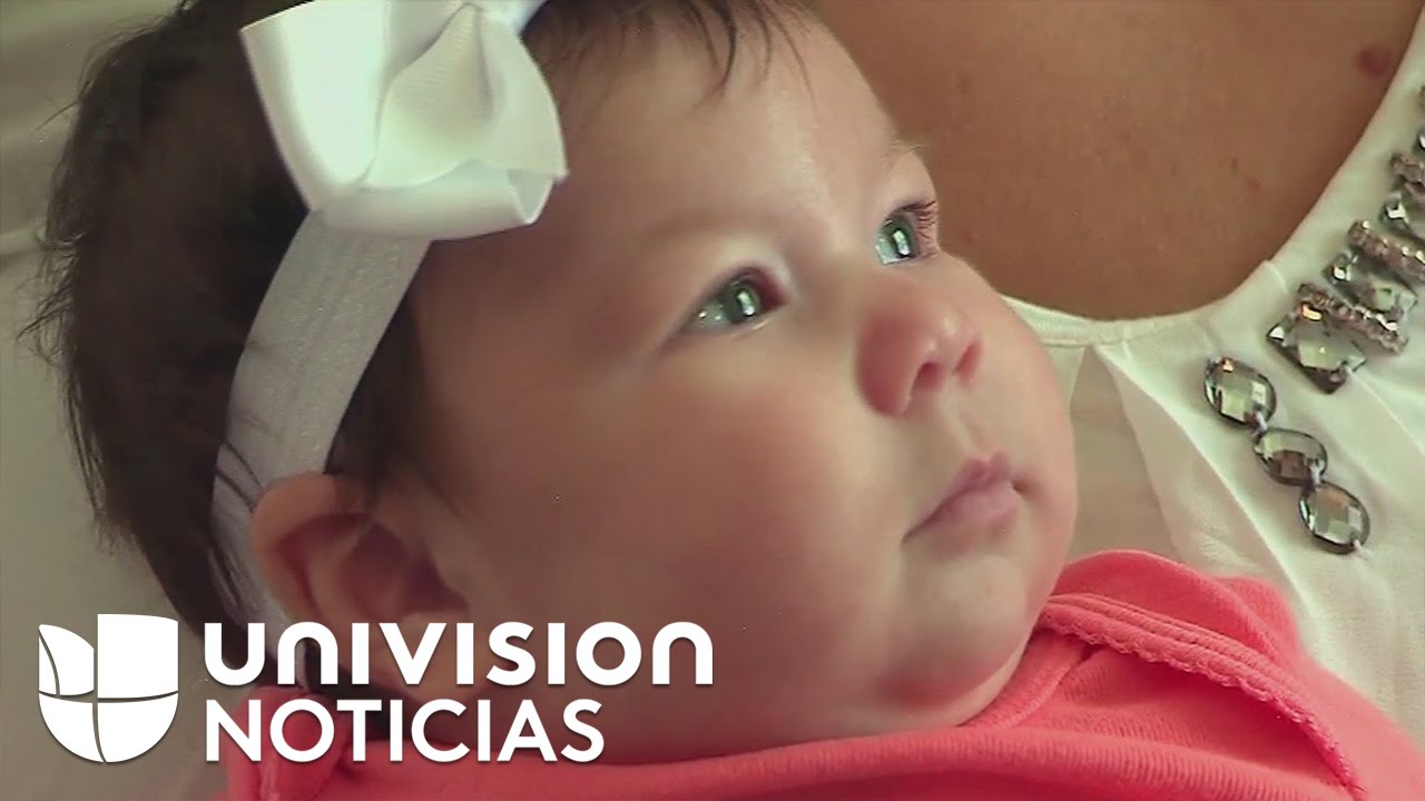 Bebé de dos meses vive las consecuencias del virus del Zika