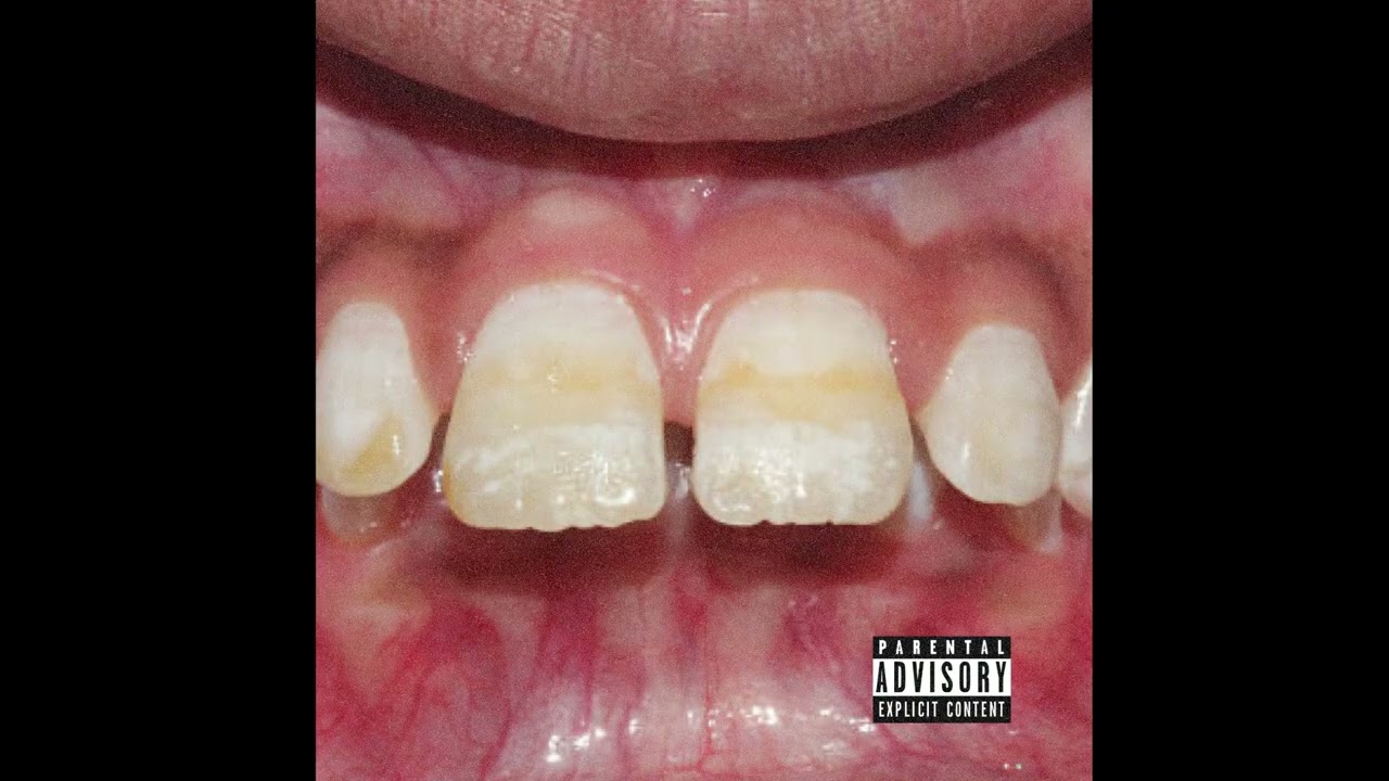 BUCKTOOTH - NOTCASUAL