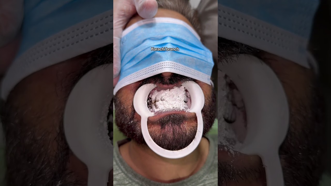 Teeth whitening powder 🦷👀👀👌#dentist #teethdecay #teethwhiteningproducts