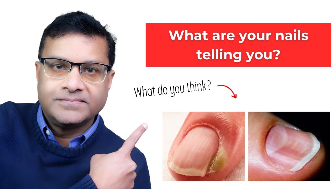 11 Warning Signs on Your Nails: What Do They Really Mean?