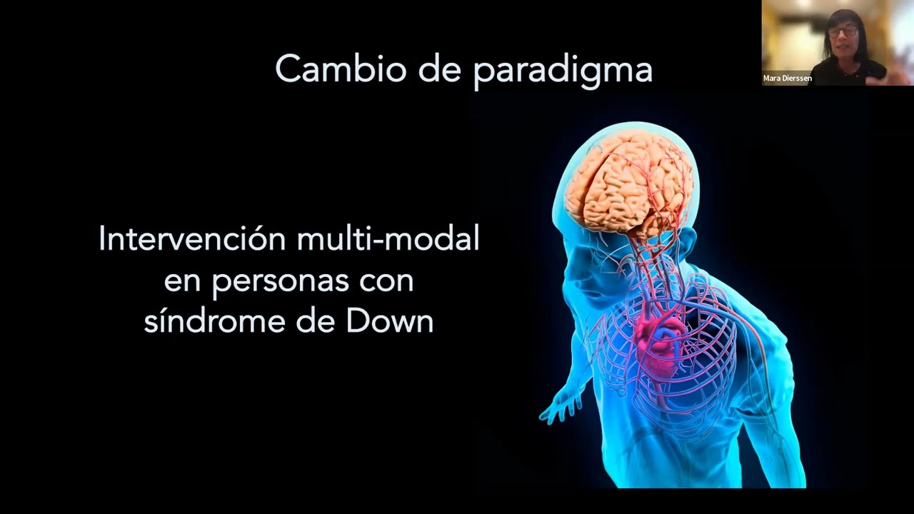 Conferencia Down: 