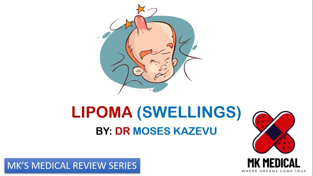 Lipoma (Swellings, tumors and masses)