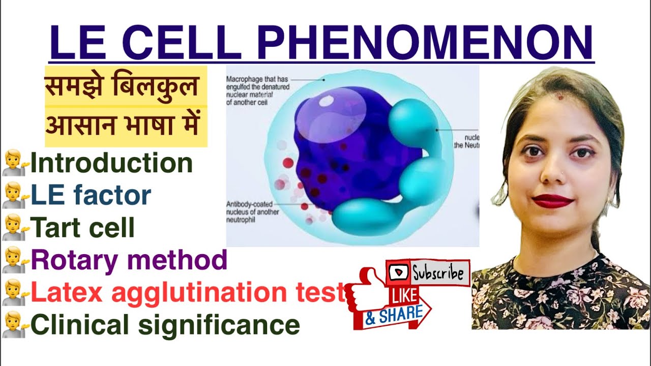 LE cell Phenomenon in Hindi | SLE | LE factor | Tart Cell | Latex agglutination test| Haematology