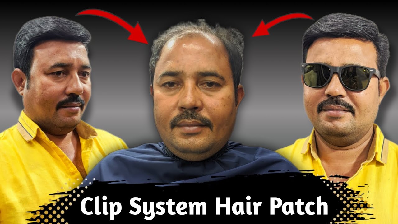 Clip System Hair Patch | Hair Clip System Review | Clip on Hair Patch | Clip System Hair Wigs 
