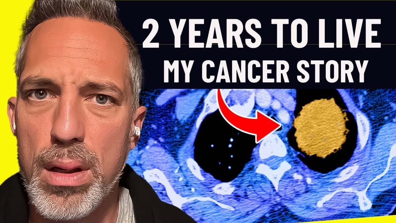 My Full Cancer Diagnosis and Treatment Plan (stage 4 terminal)