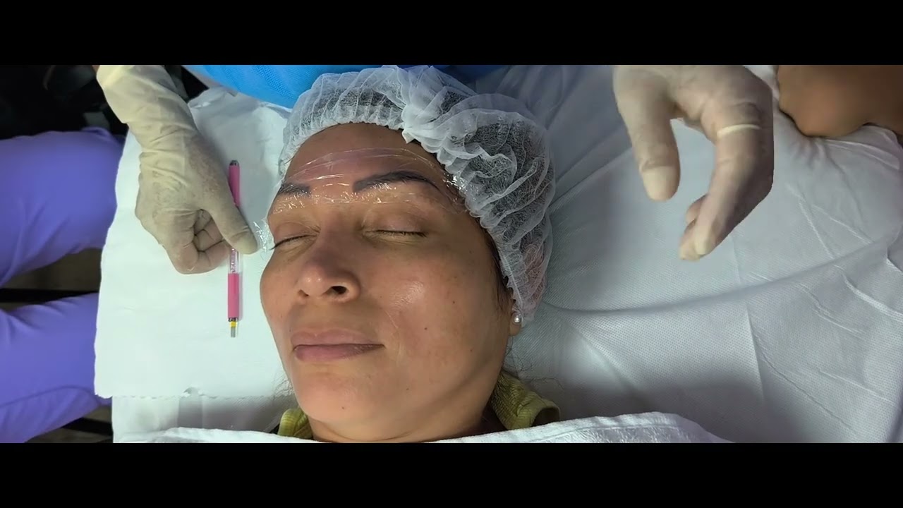 Remoción de pigmento en cejas-Micropigmentación