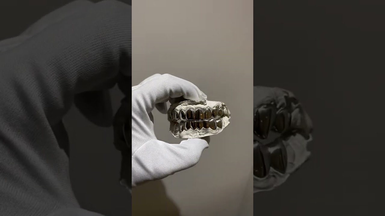 16 set grillz #grillz #jewellery #goldgrillz