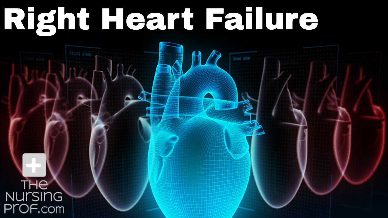 Right Heart Failure