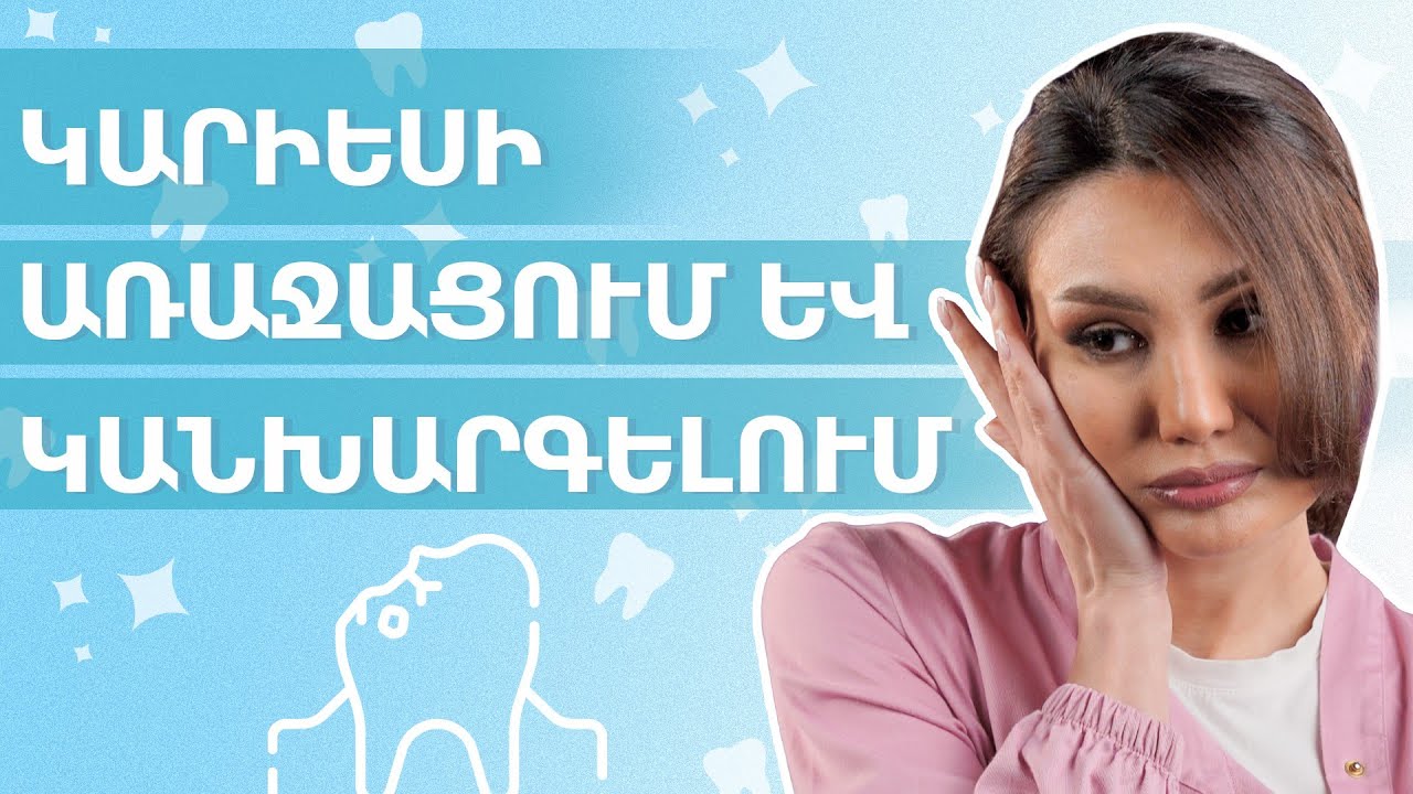 Կարիես․ ախտանշաններ և բարդացումներ երեխաների մոտ | StomTales 07