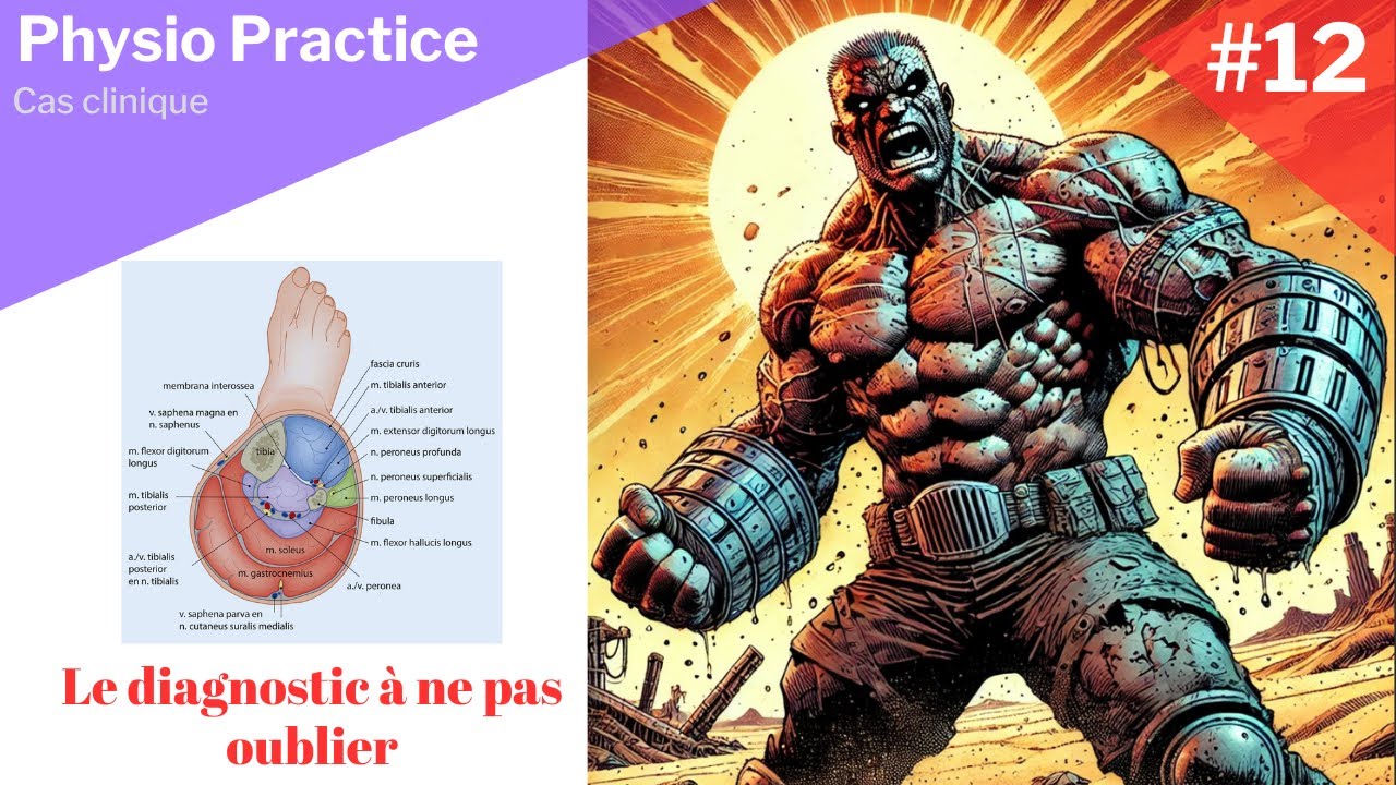 Le diagnostic différentiel que tu rates à chaque fois (c'est pas toujours une tendinite)