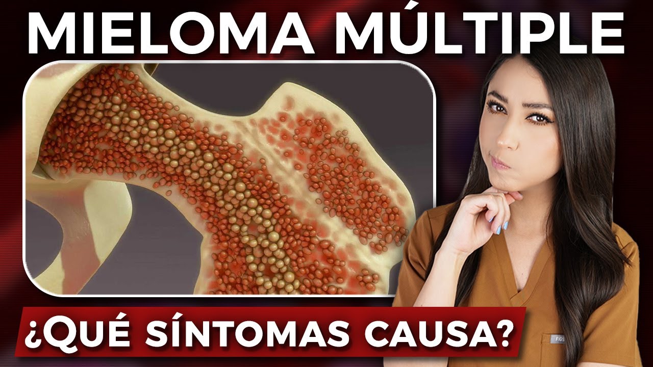 Señales de MIELOMA MÚLTIPLE⚠️🩸 l @Dra. Pau Zúñiga