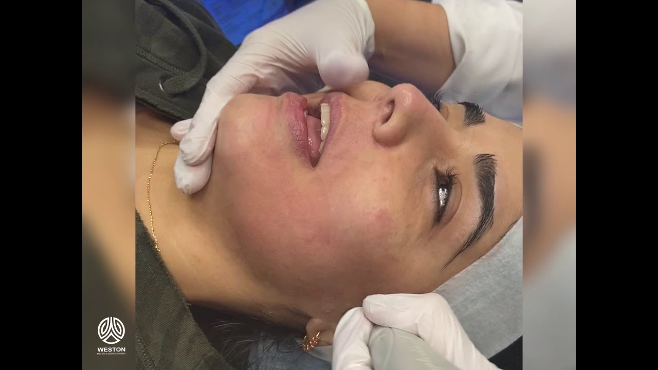 Upgrade your HYDRAFACIAL with the WET DIAMOND TIP